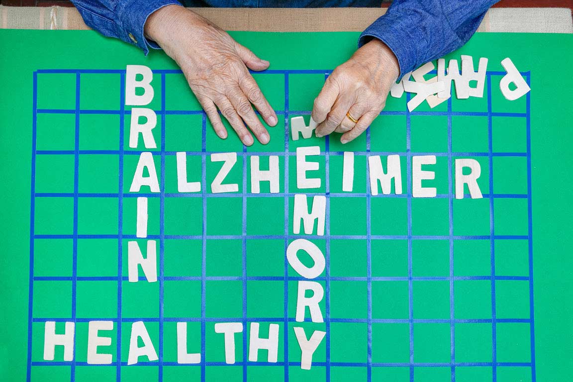 Brain Health & Alzheimer's Disease Alpha lipoic acid may help prevent and treat Alzheimer's disease.