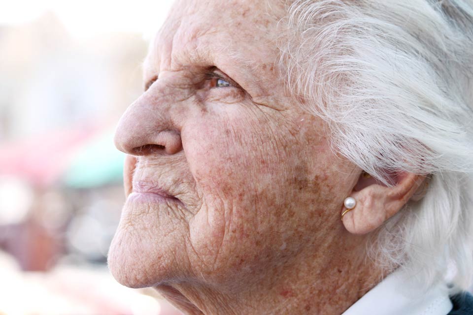 Aging Skin Hyperpigmentation & Age Spots Sun exposure, UV radiation, and aging can cause hyperpigmentation in skin known as age spots.