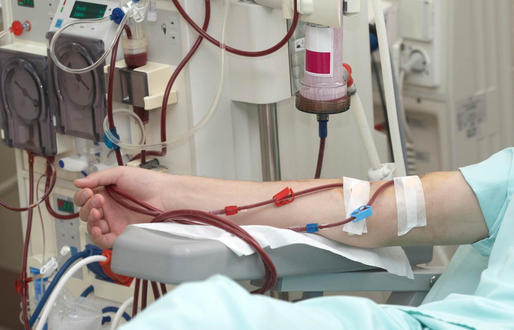Alpha lipoic acid could help keep your kidneys healthy. Kidney Health
