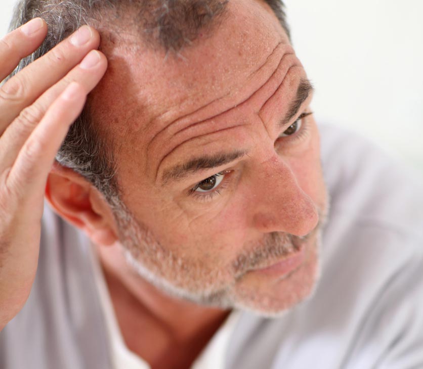 Help stop hair loss with antioxidants such as anti-inflammatory alpha lipoic acid.